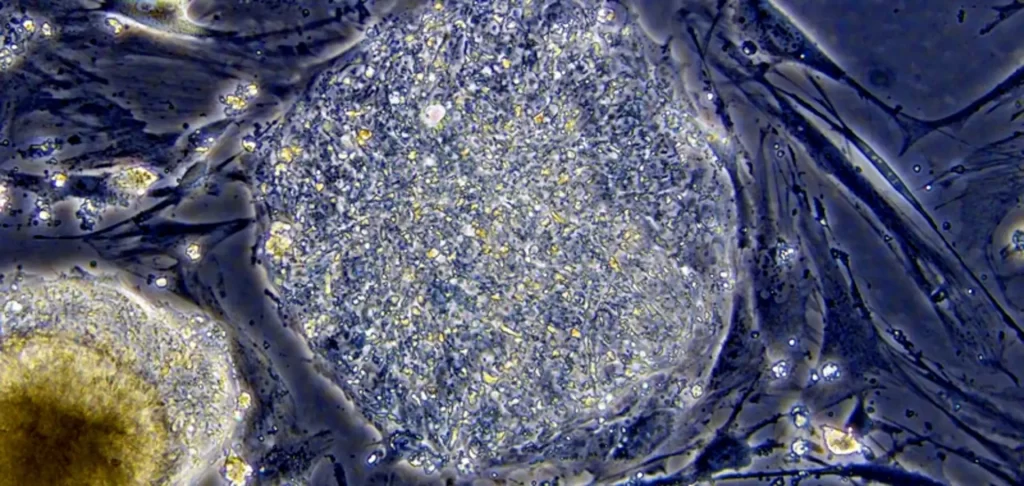 Focus on Stem cell and Cord Blood banking - Stem cell Research